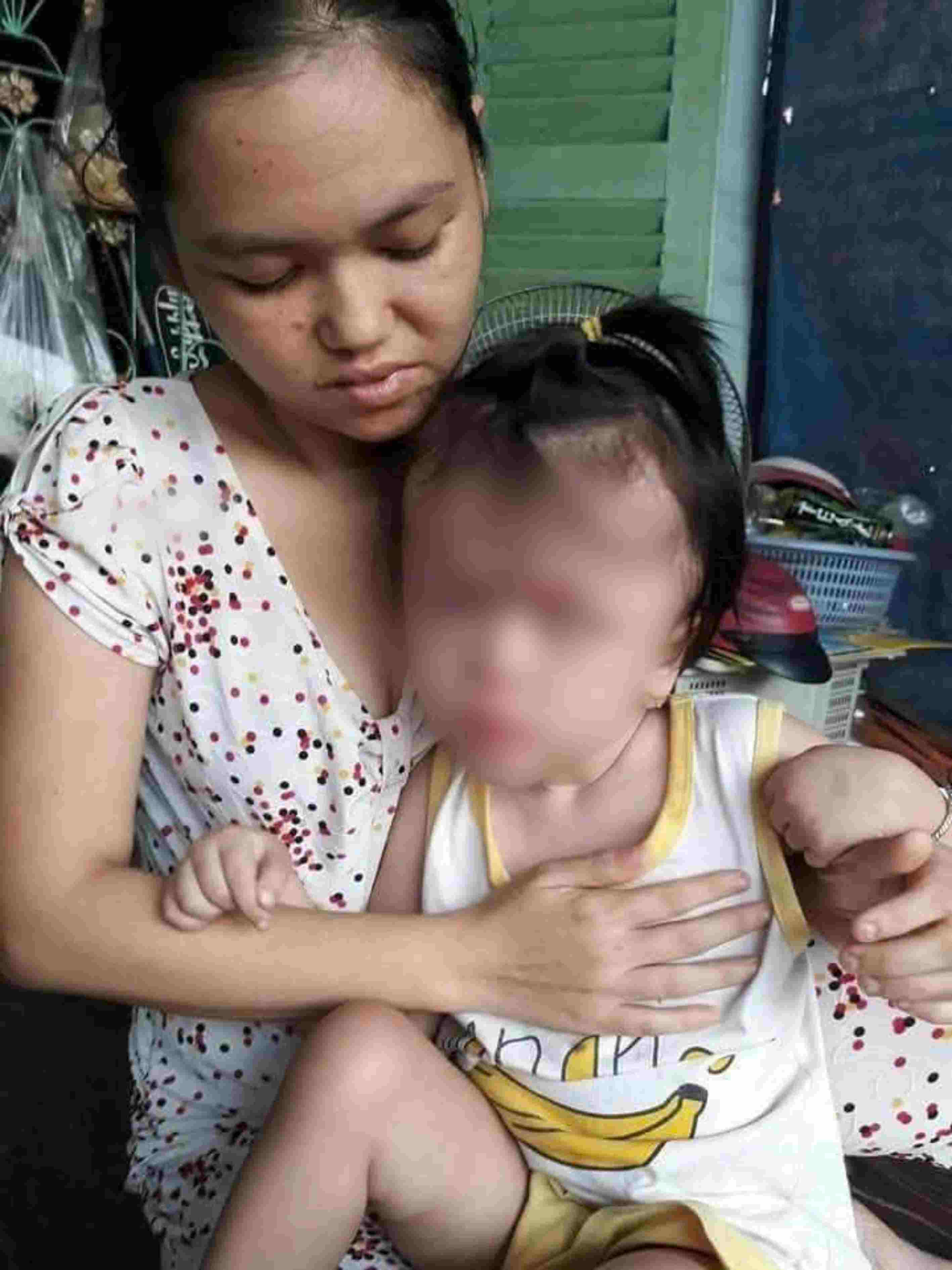 Bé Trần Ngọc Thùy Linh mắc não úng thủy, gia đình kiệt quệ vì lo chạy chữa cho con. Ảnh: Gia đình cung cấp
