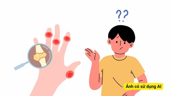Tăng axit uric máu không triệu chứng vẫn có thể gây tổn thương âm thầm cho tim mạch, thận. Ảnh đồ hoạ: Hương Sơn/ Ảnh có sử dụng AI