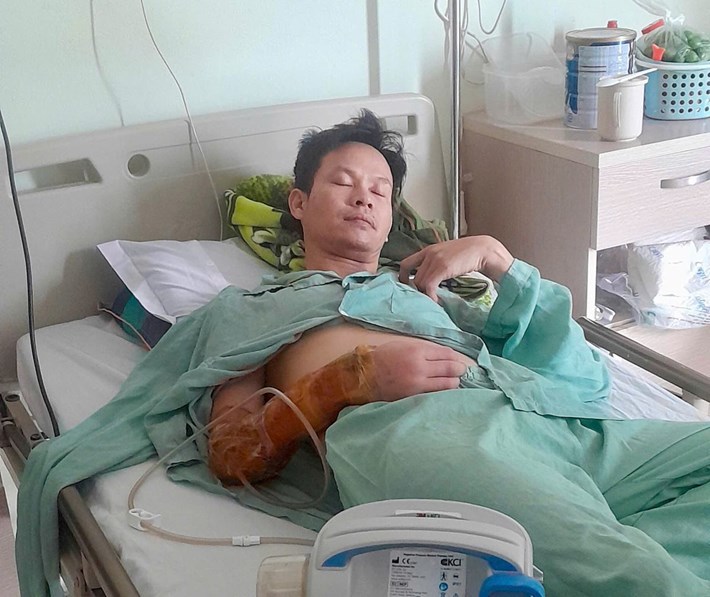 Anh Bùi Quang Hành (xã Tiên Lãng, Hải Phòng) bị chấn thương nặng sau tai nạn lao động. Ảnh: Nhân vật cung cấp