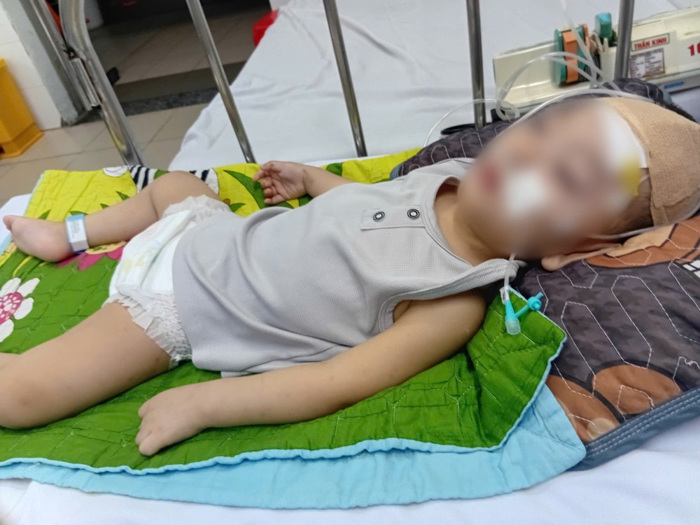 LD26200: Poor family exhausted because child has brain disease, epilepsy